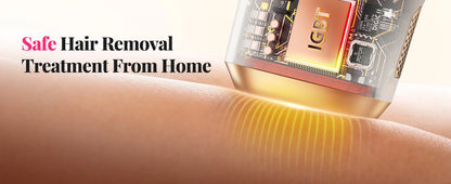 ✨💖 990000 Flashes IPL Laser Hair Removal Device – Painless Permanent Hair Remover for Women & Men